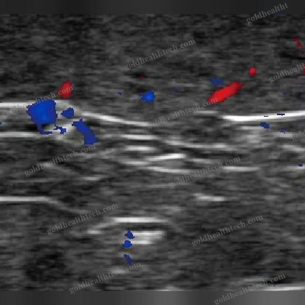 Portable Veterinary Ultrasound System