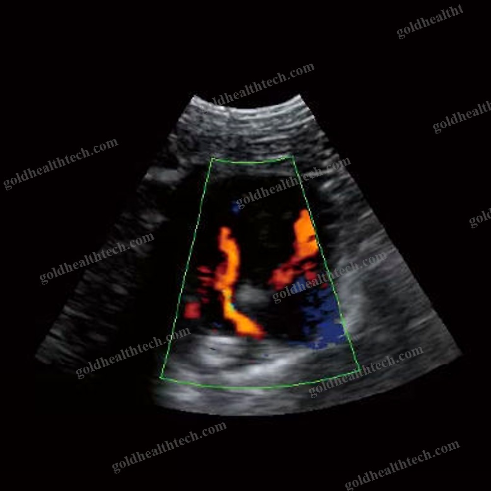 Portable Veterinary Ultrasound System