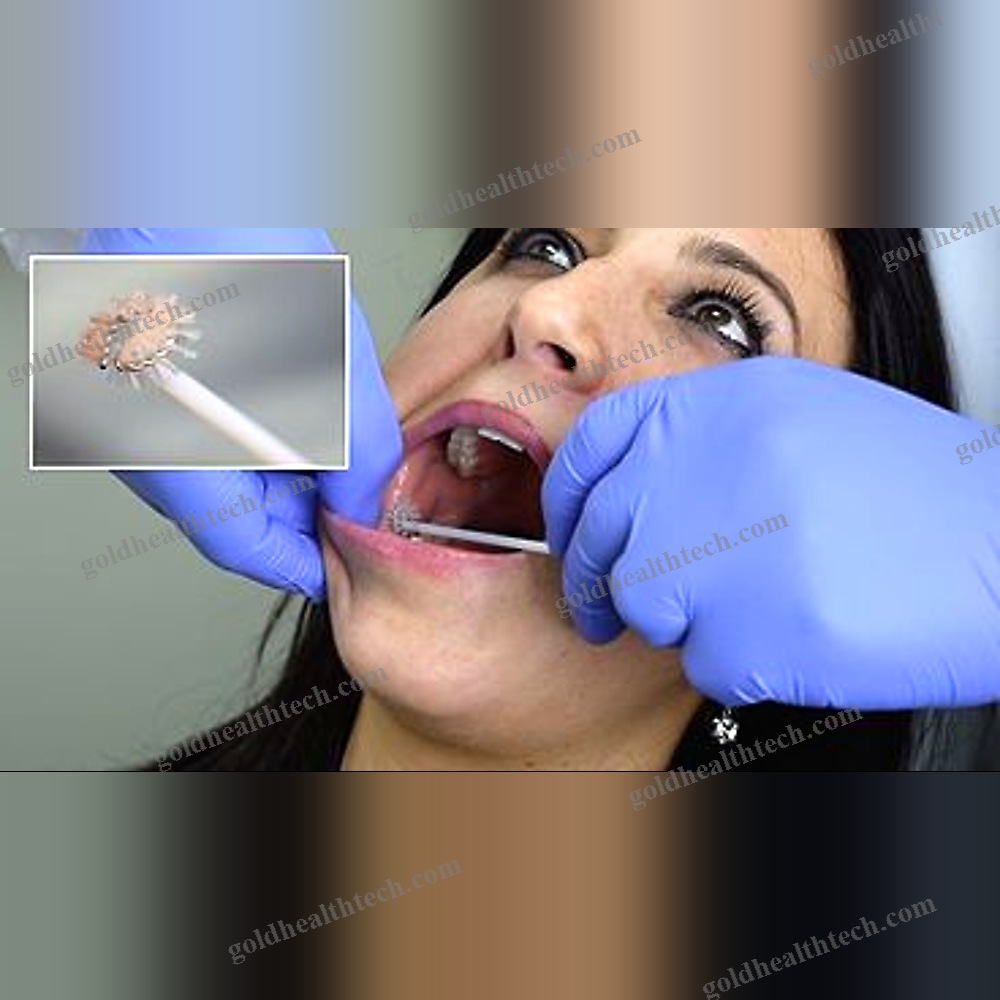 Buccal Cytology Brush