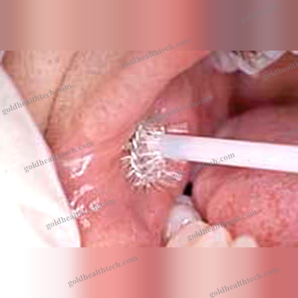 Buccal Cytology Brush