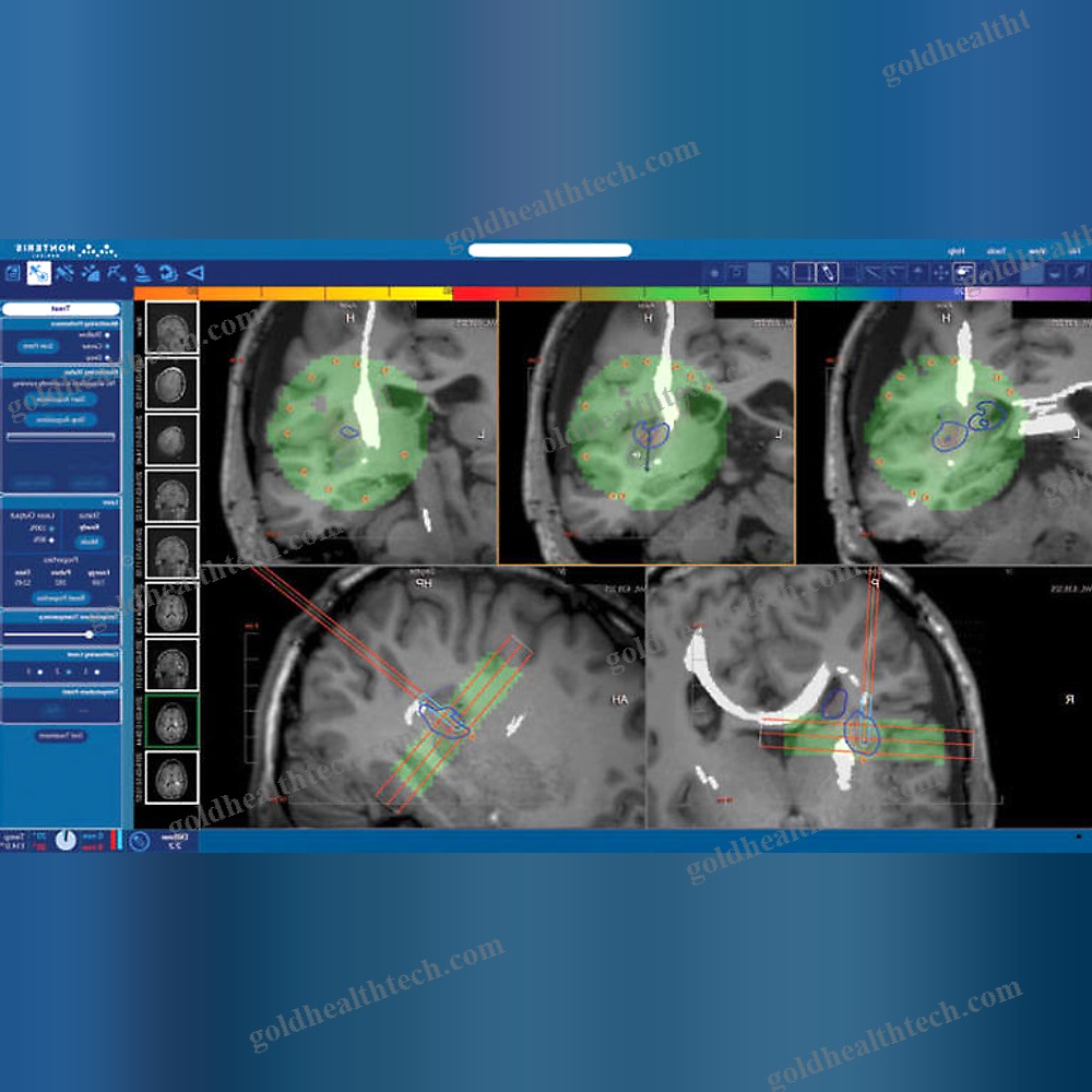 Medical Imaging Software