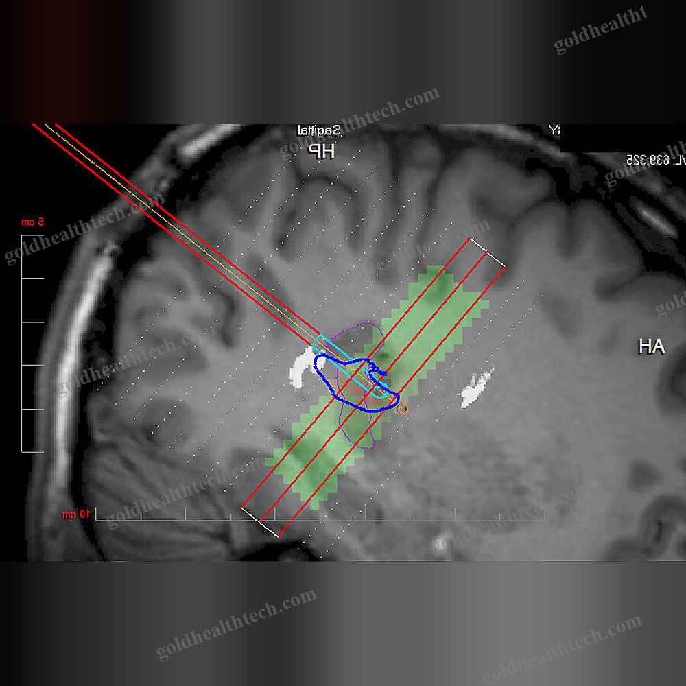 Medical Imaging Software