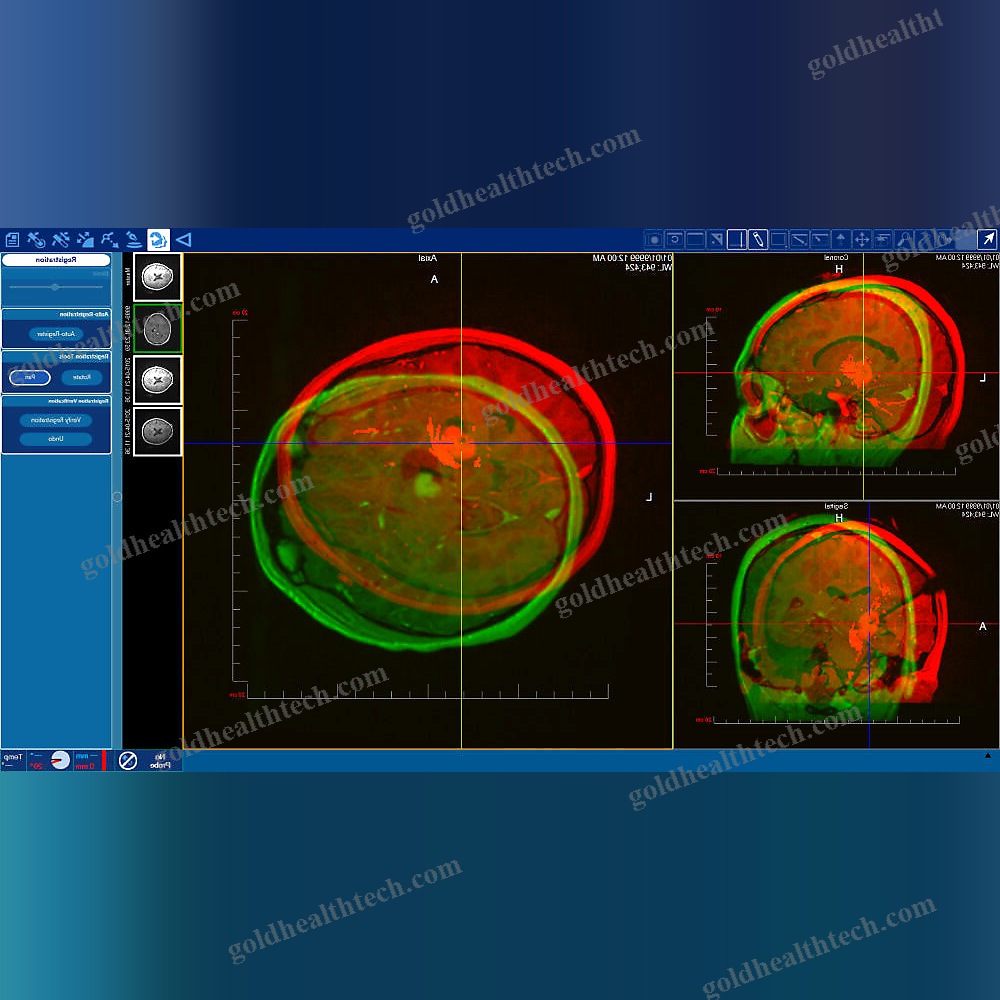 Medical Imaging Software