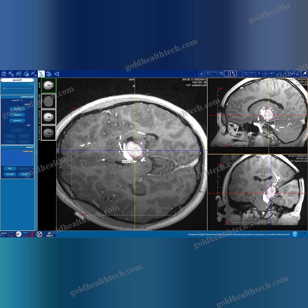 Medical Imaging Software
