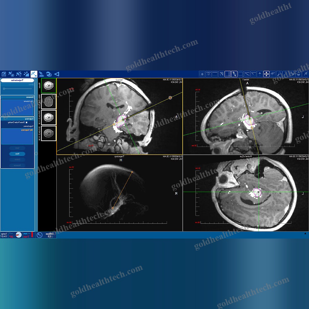 Medical Imaging Software