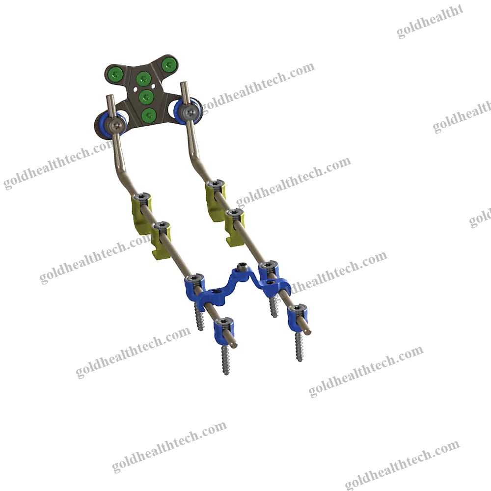 Occipito-Cervico-Thoracic Osteosynthesis Unit