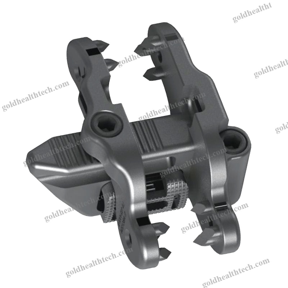 Lumbar Interspinous Vertebral Implant