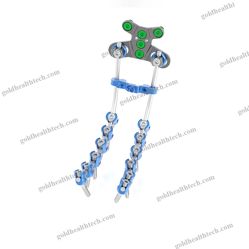 Occipito-Cervico-Thoracic Osteosynthesis Unit