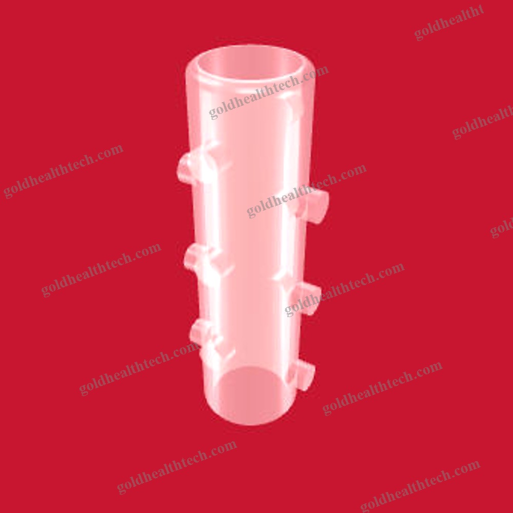 Tracheal Stent