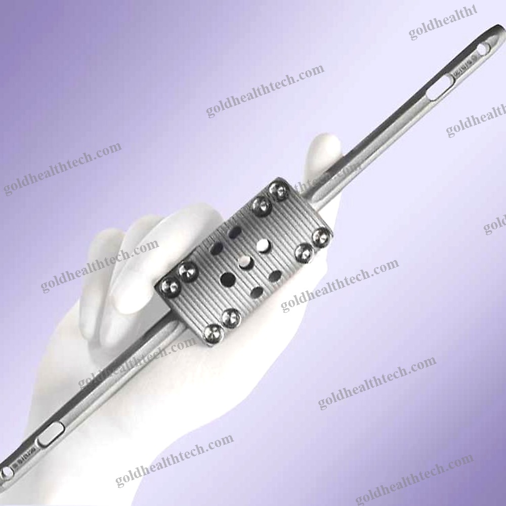 Femoral Intramedullary Nail