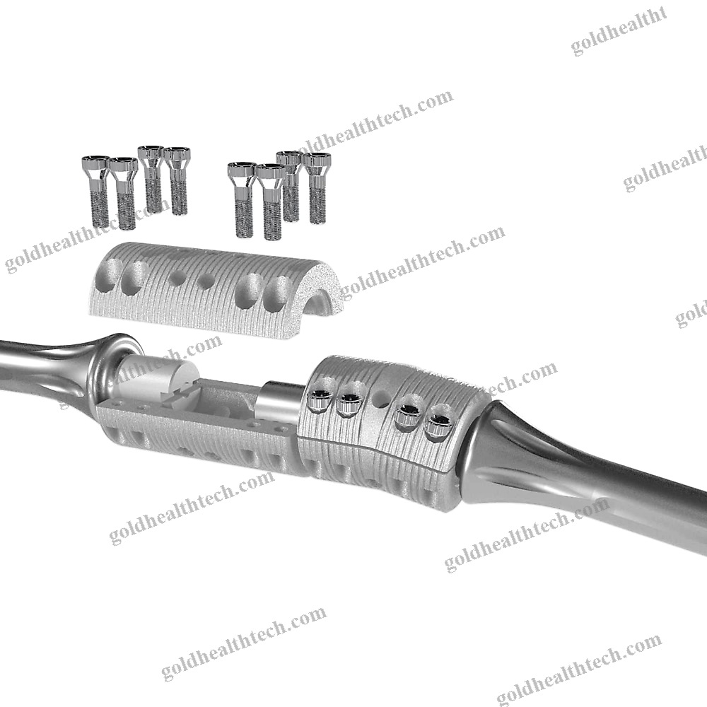 Femoral Intramedullary Nail