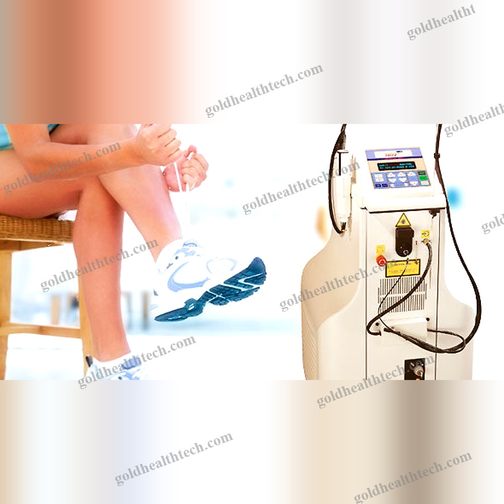 Vascular Lesion Treatment Laser