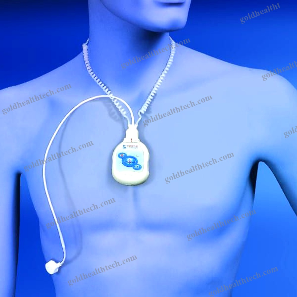 Ecg Event Recorder