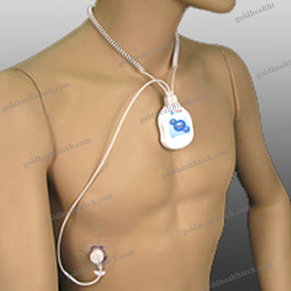 Ecg Event Recorder