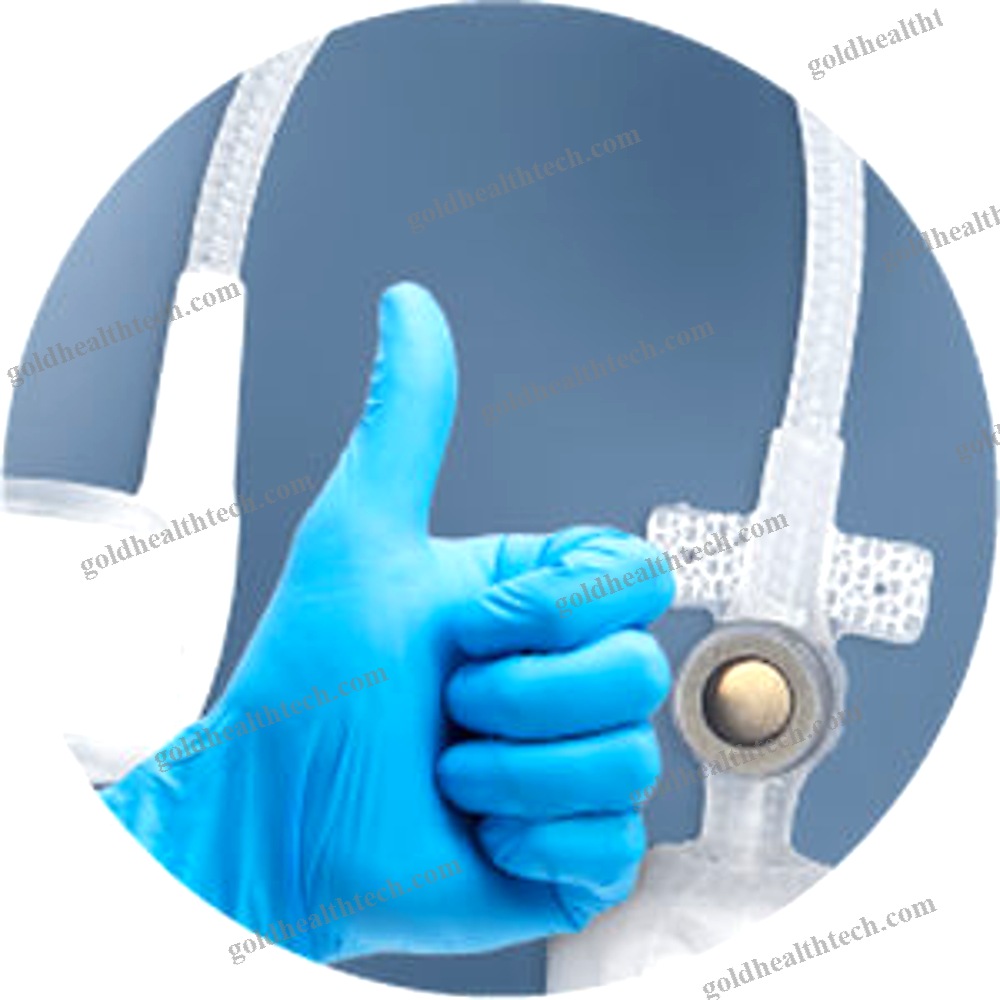 Vesical Sphincter Prosthesis