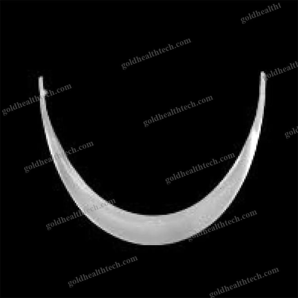 Chin Implant