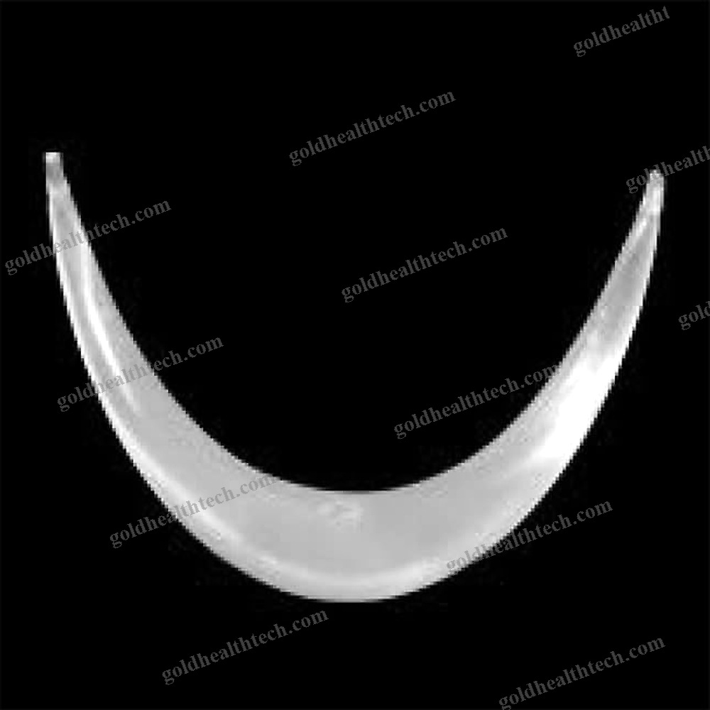 Chin Implant