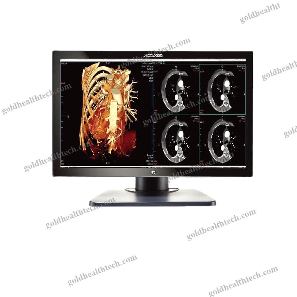 Diagnostic Display