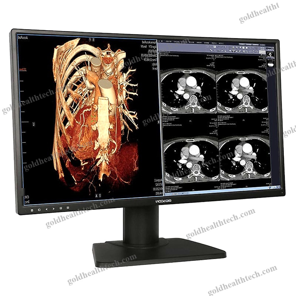Diagnostic Display
