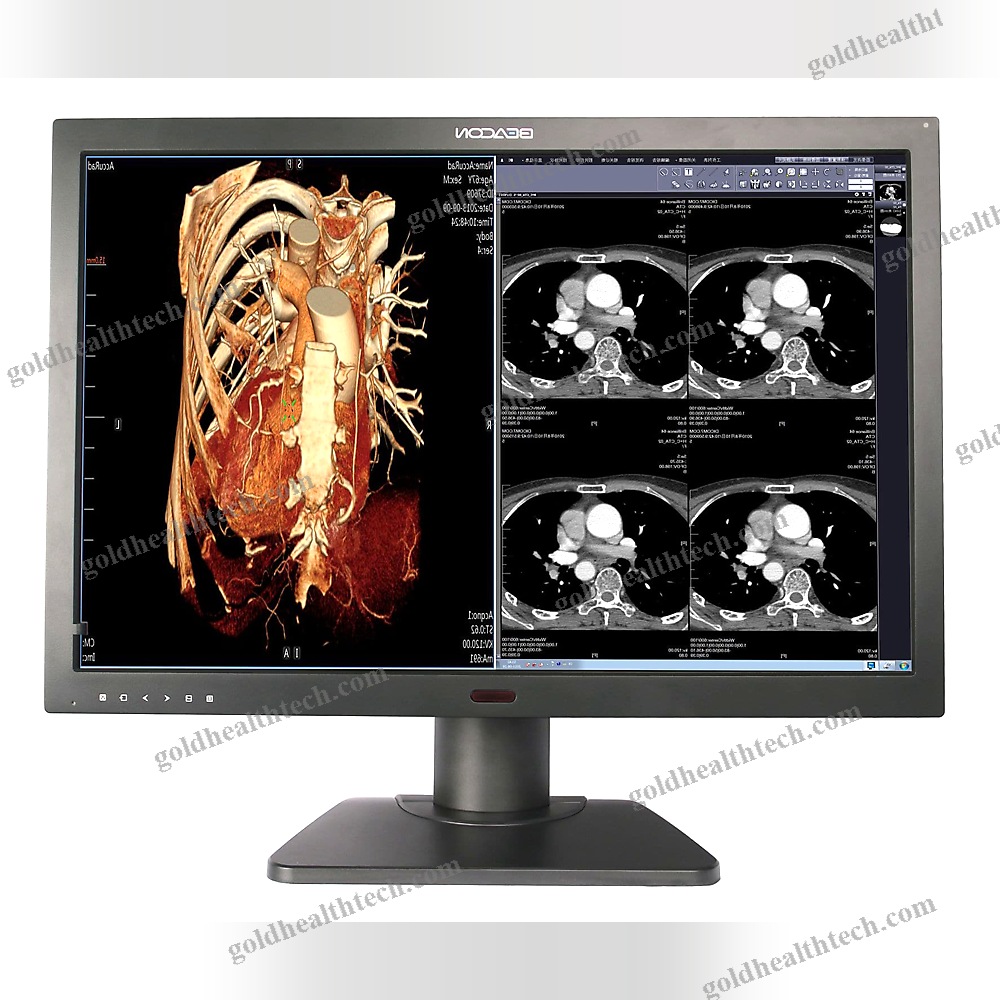 Diagnostic Display
