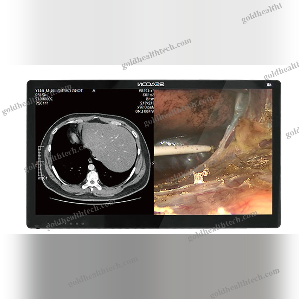 Endoscopy Display
