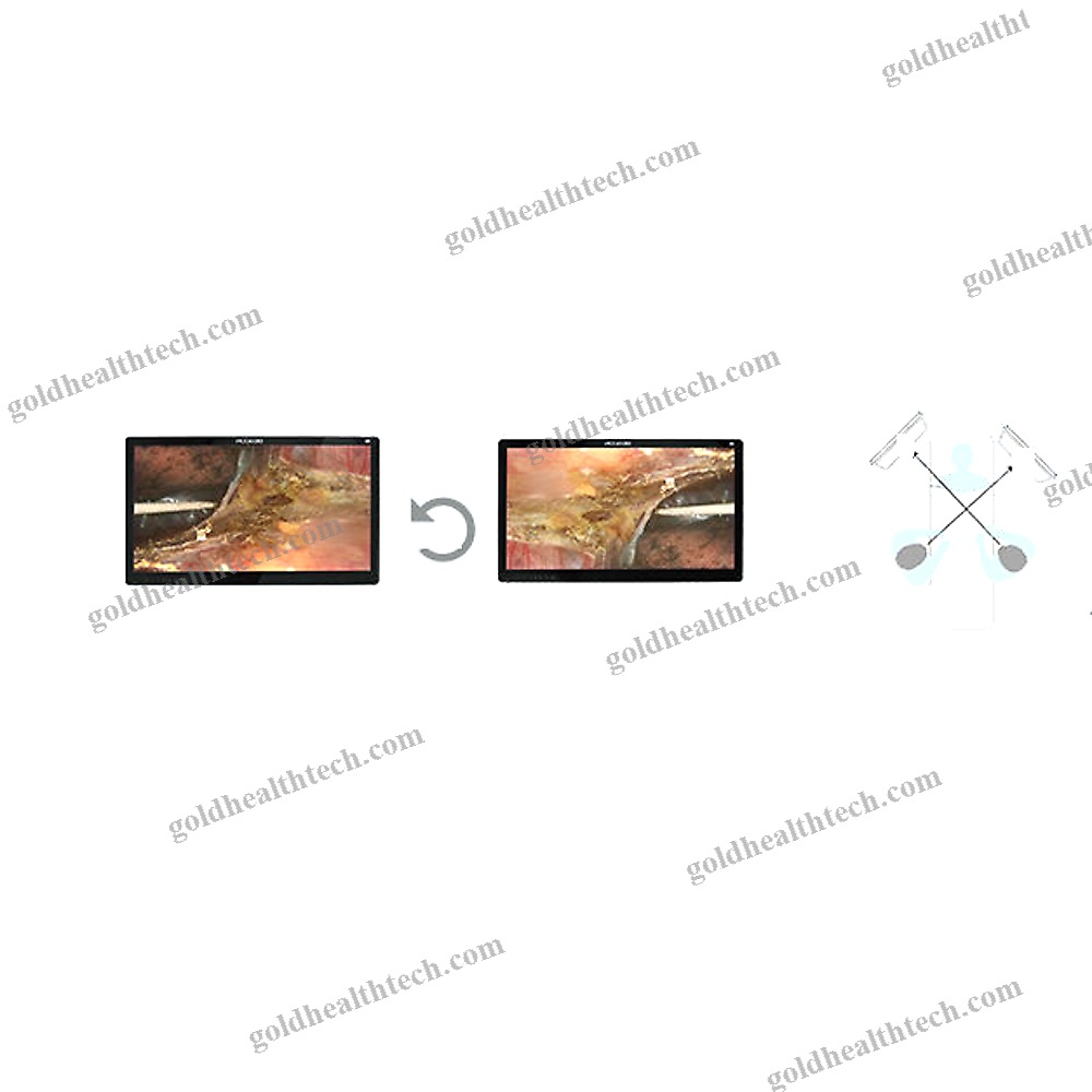 Endoscopy Display
