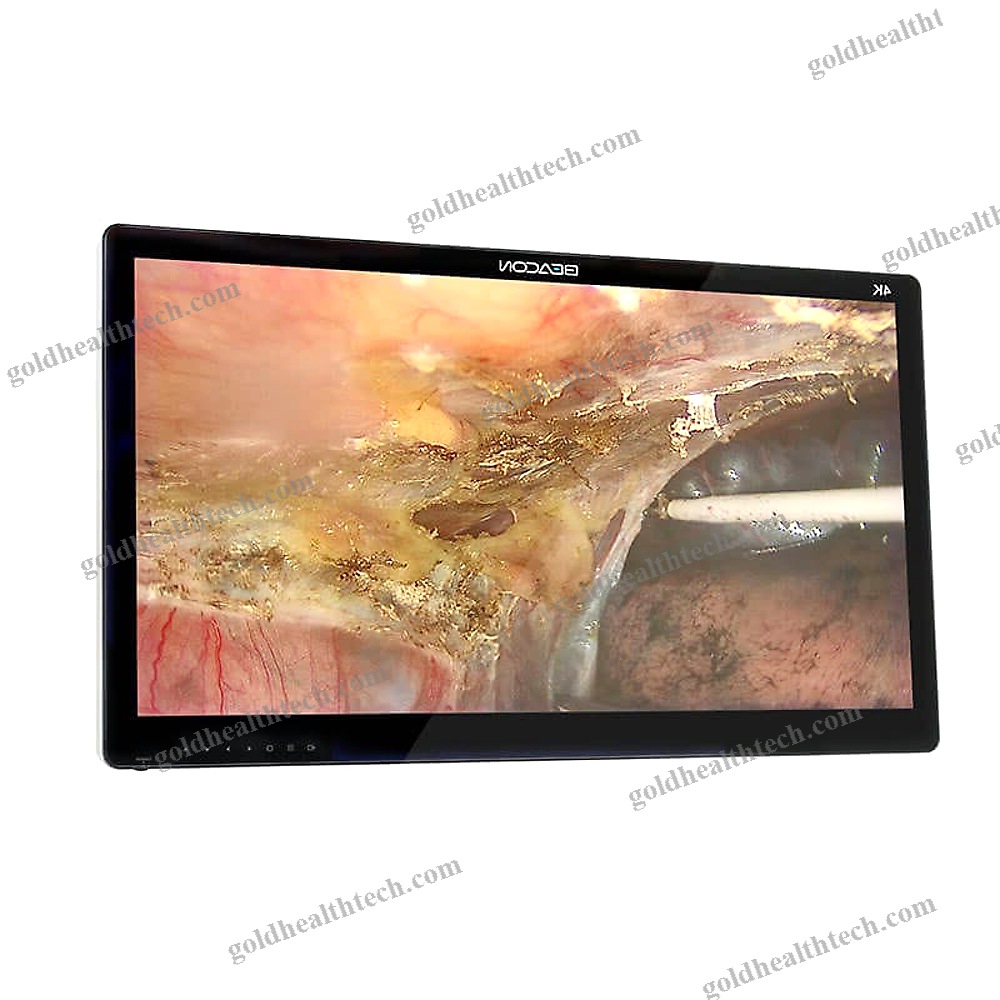 Endoscopy Display
