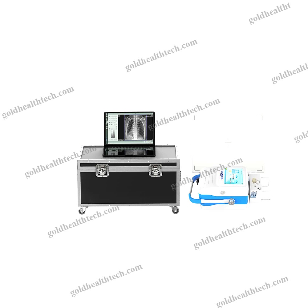 Portable Radiography System