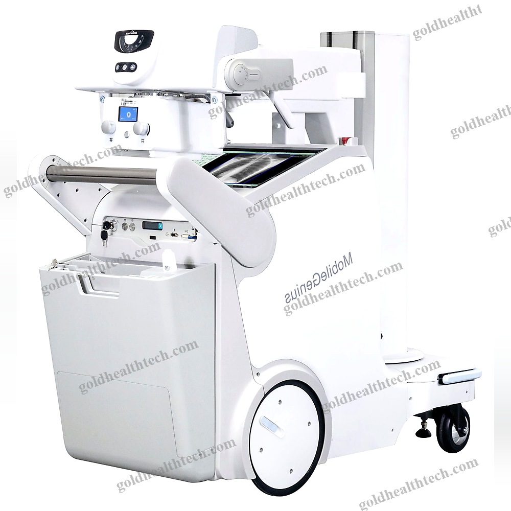 Digital Mobile Radiography Unit