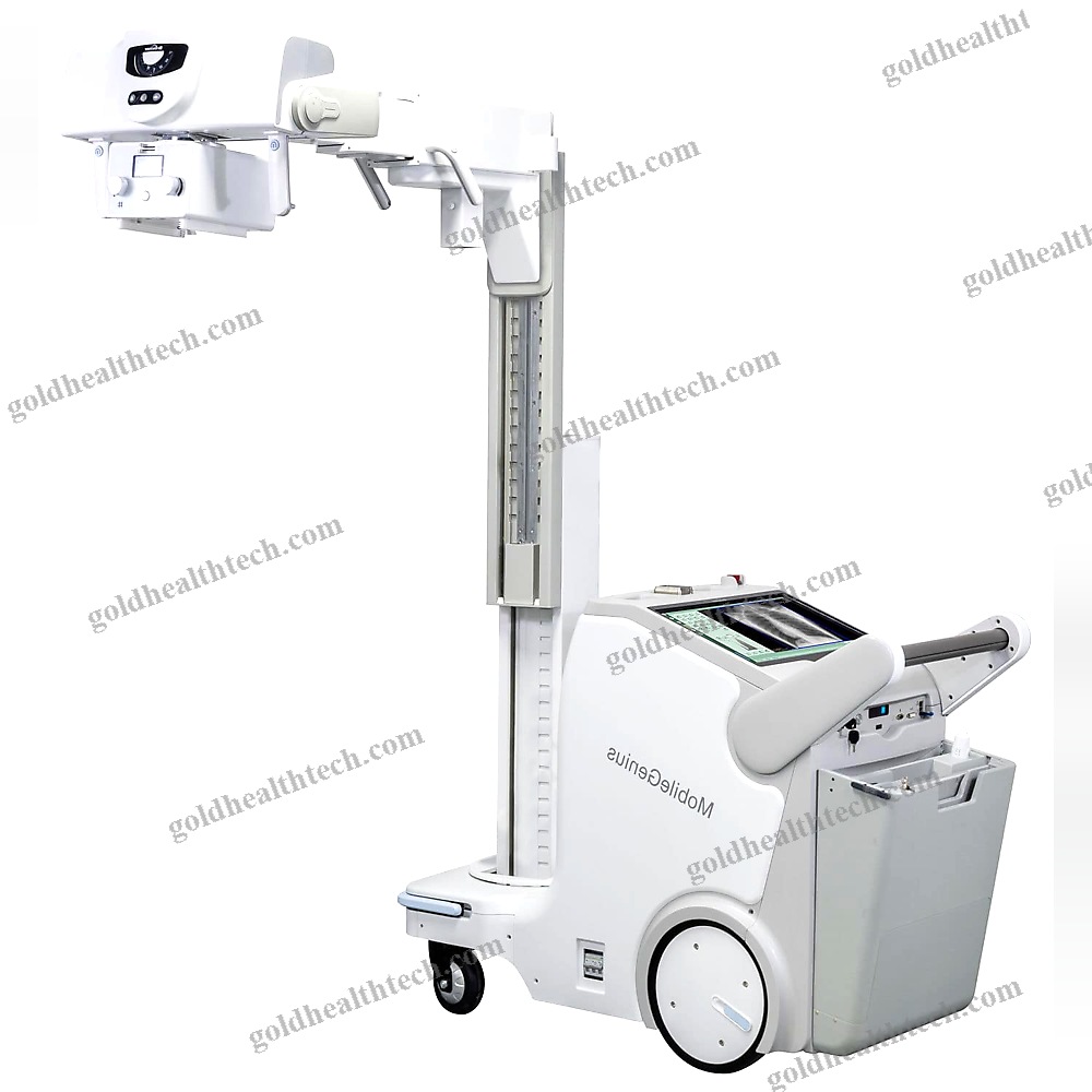 Digital Mobile Radiography Unit