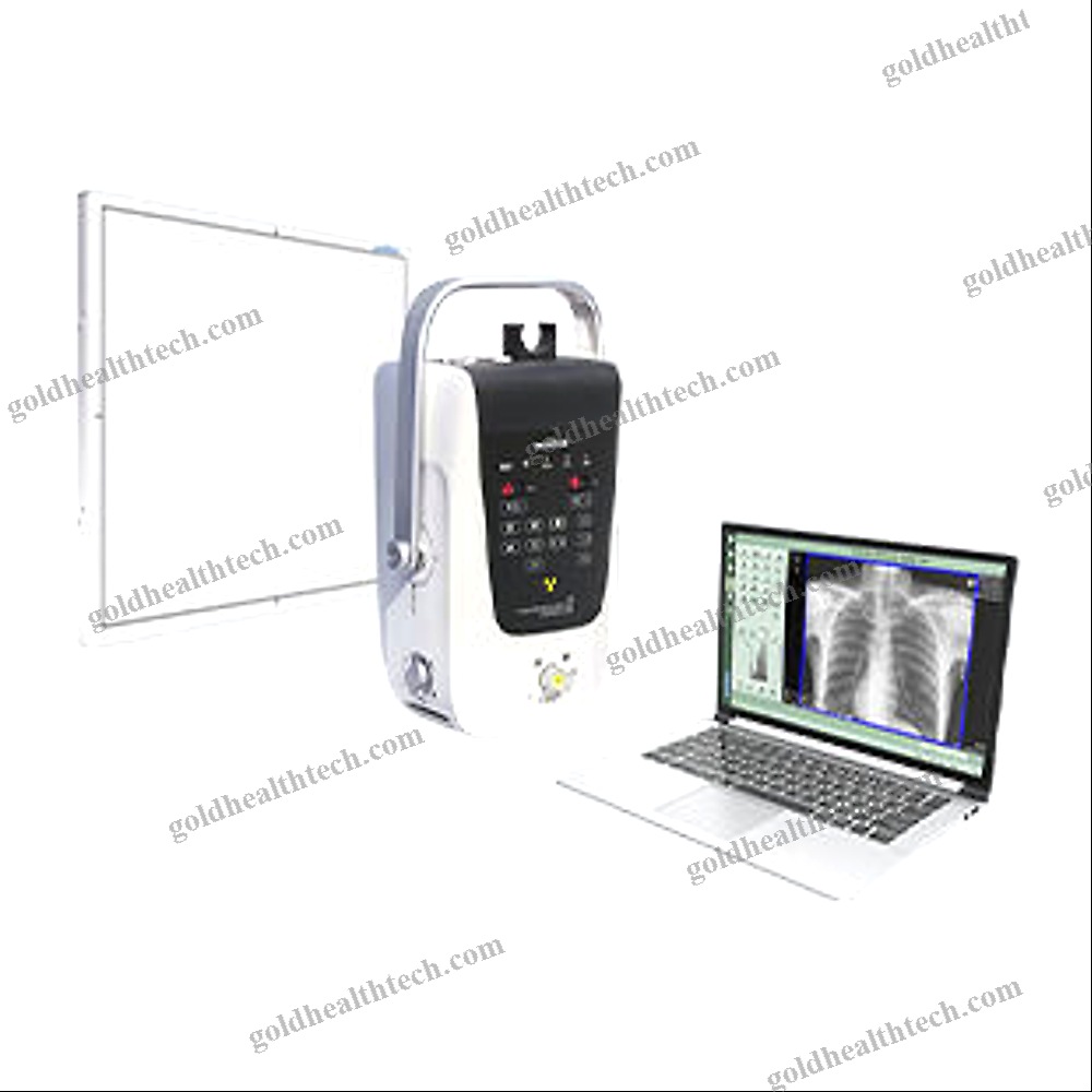 Portable Radiography System