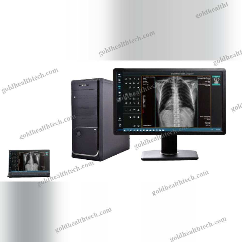 Radiography Acquisition System