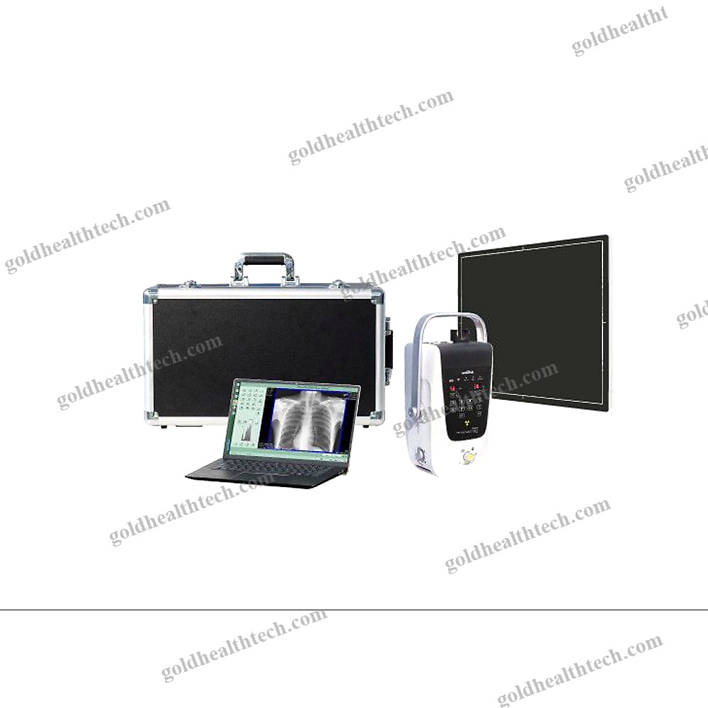 Portable Radiography System