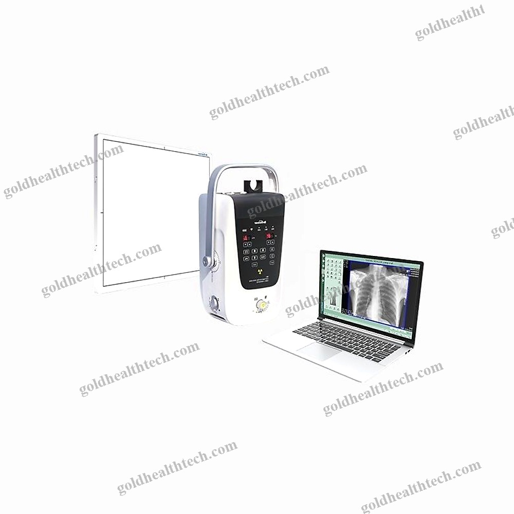 Portable Radiography System