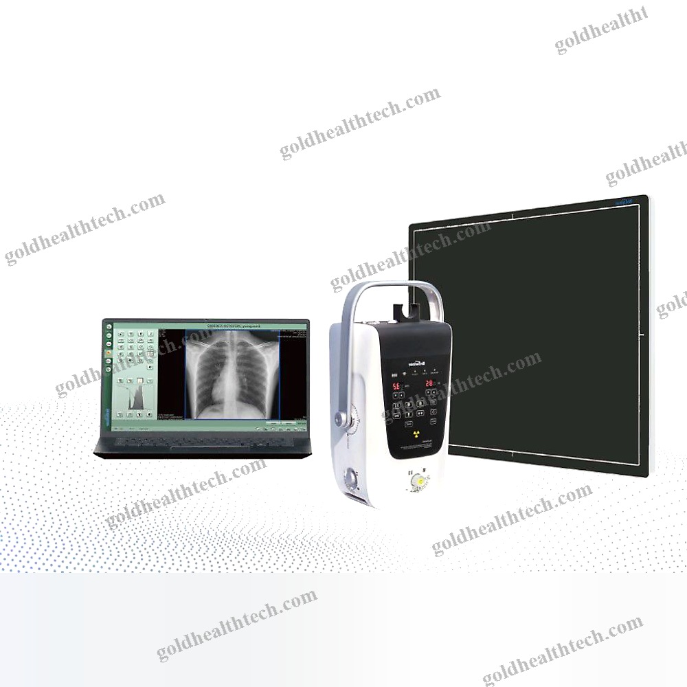 Portable Radiography System
