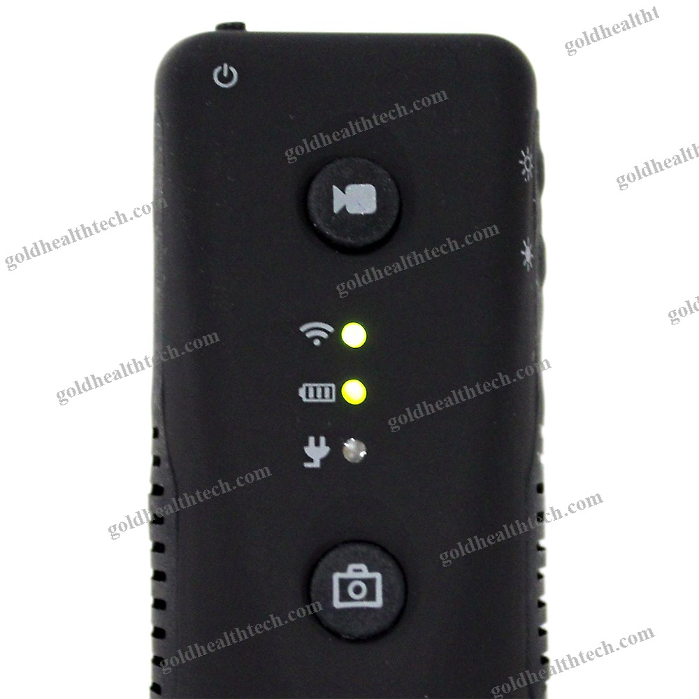 Video Dermatoscope