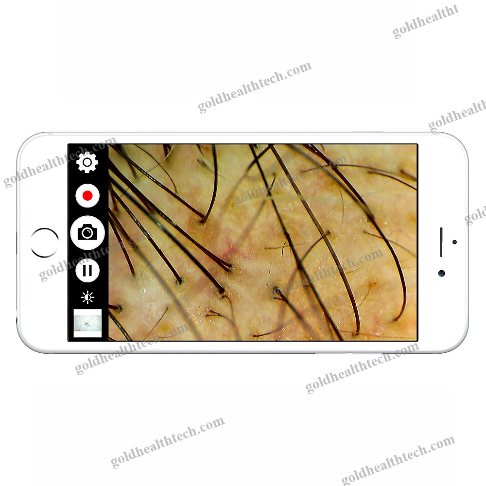 Video Trichoscope