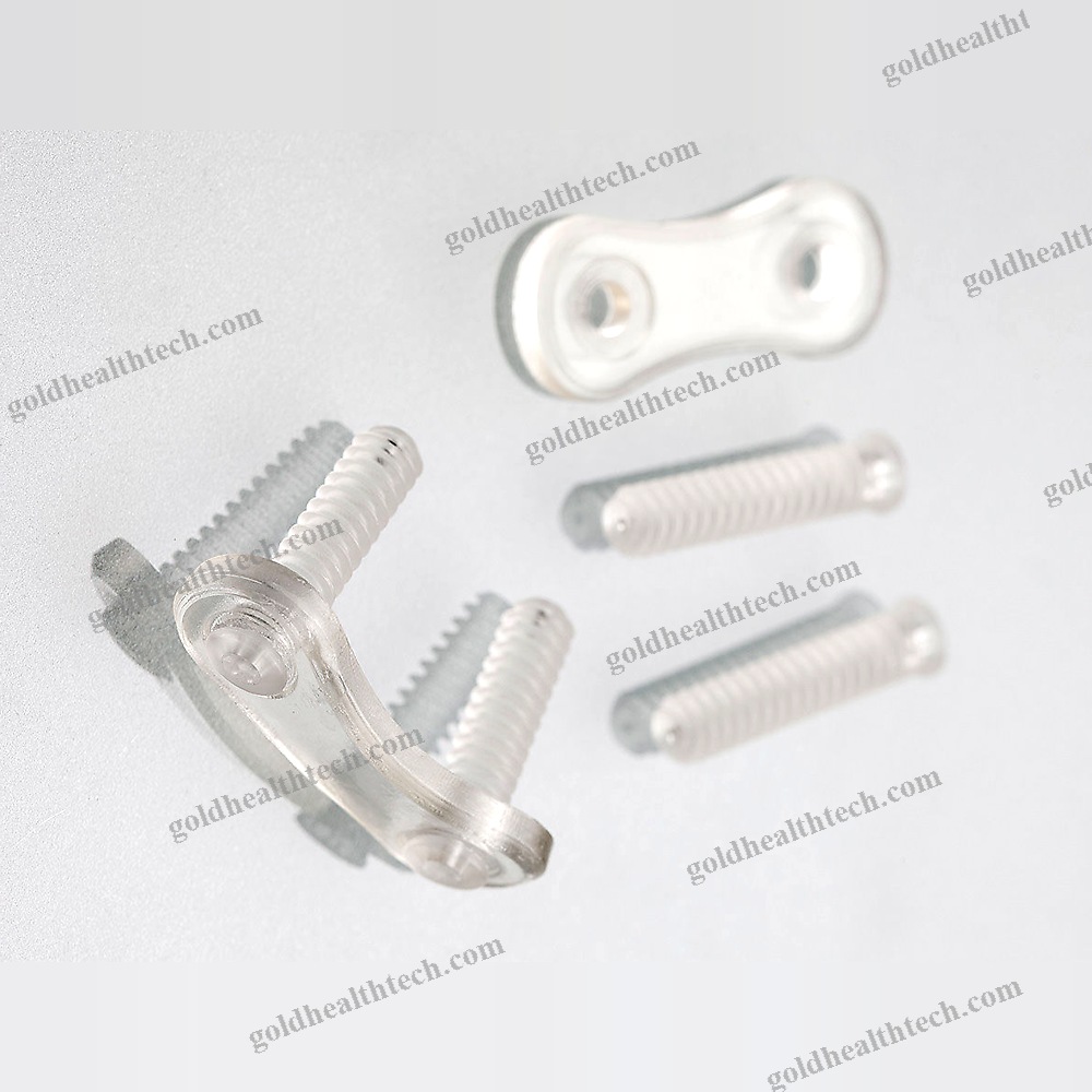 Thoraco-Lumbar Arthrodesis Plate