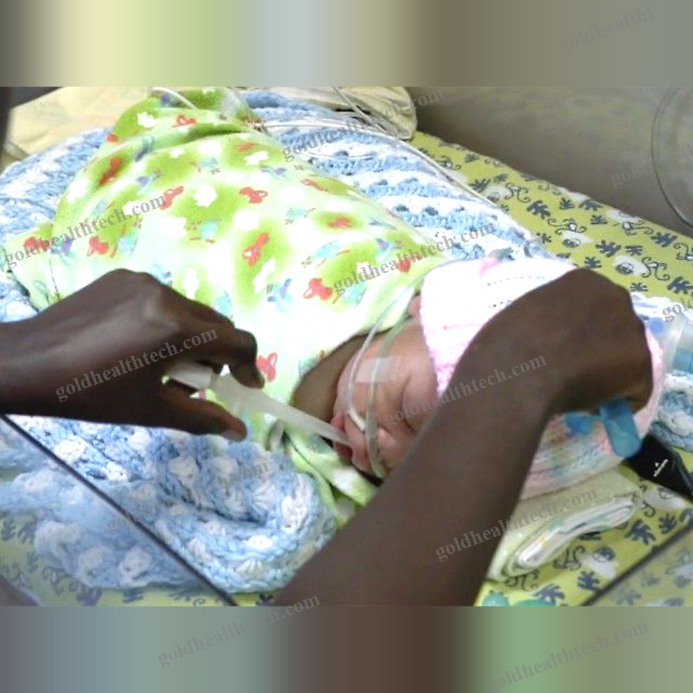 Nasal Mucus Suction Cannula