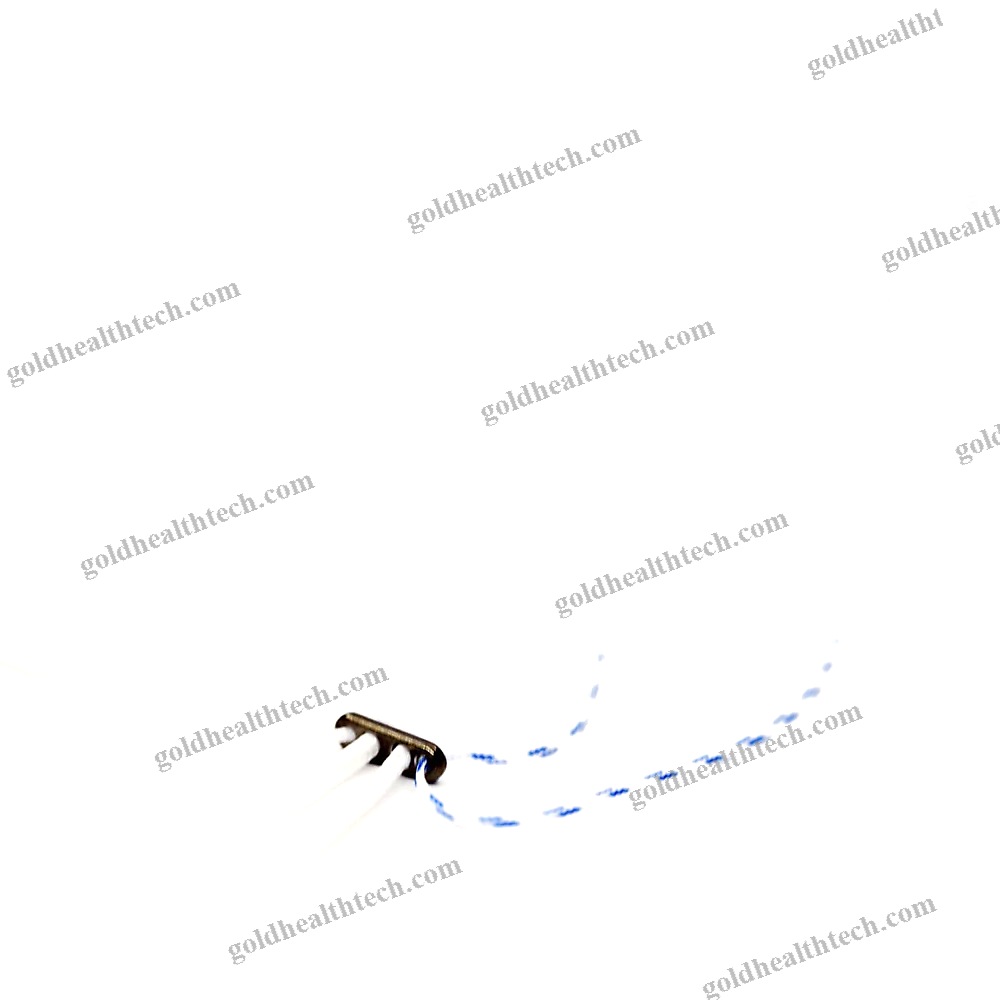 Acl Reconstruction Suture Button