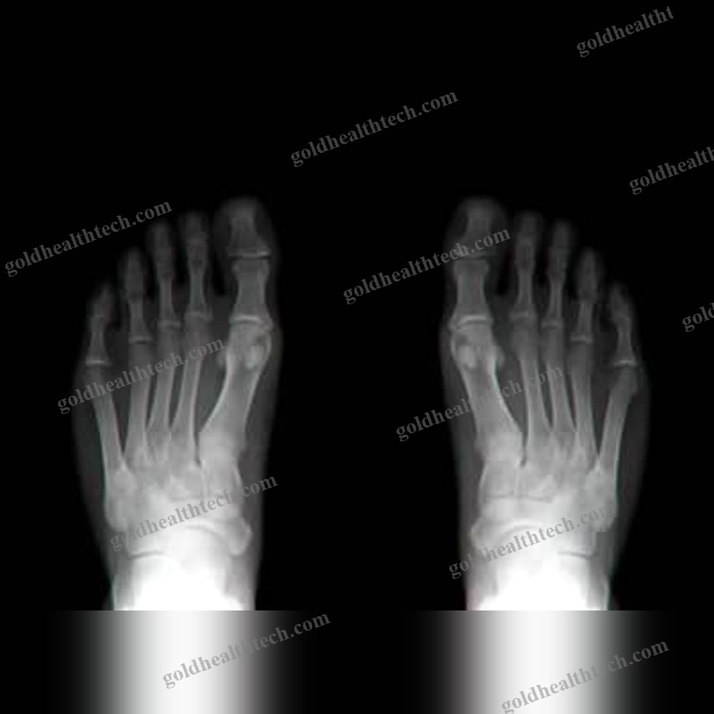 Analogic Mobile Radiography Unit