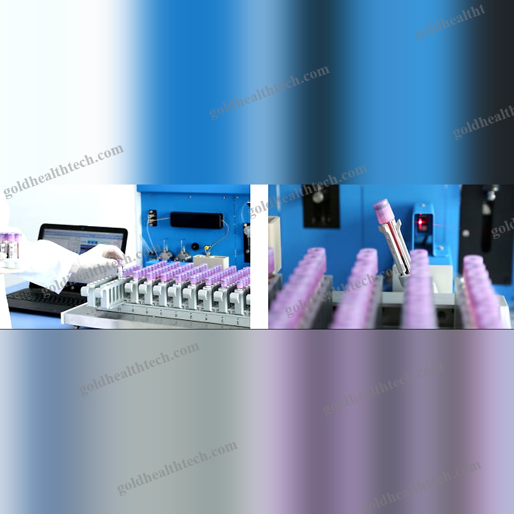 Automated Hba1C Analyzer