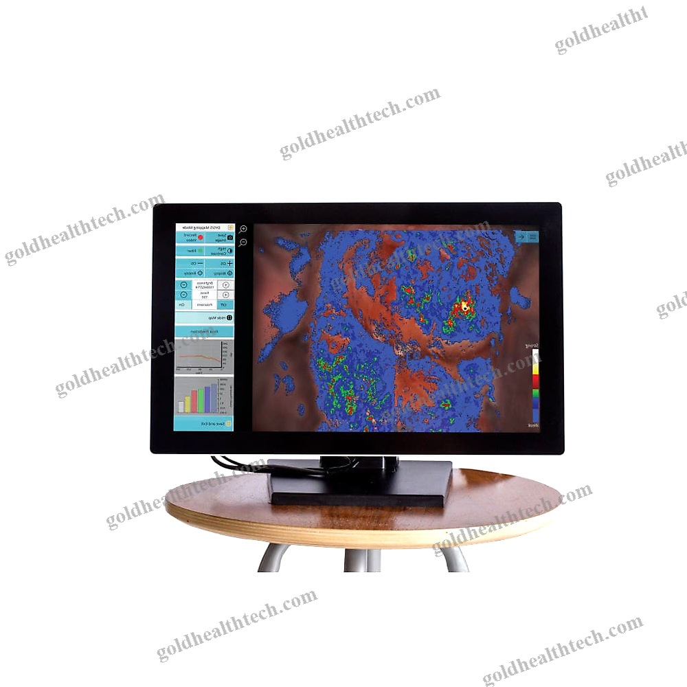 Video Colposcope