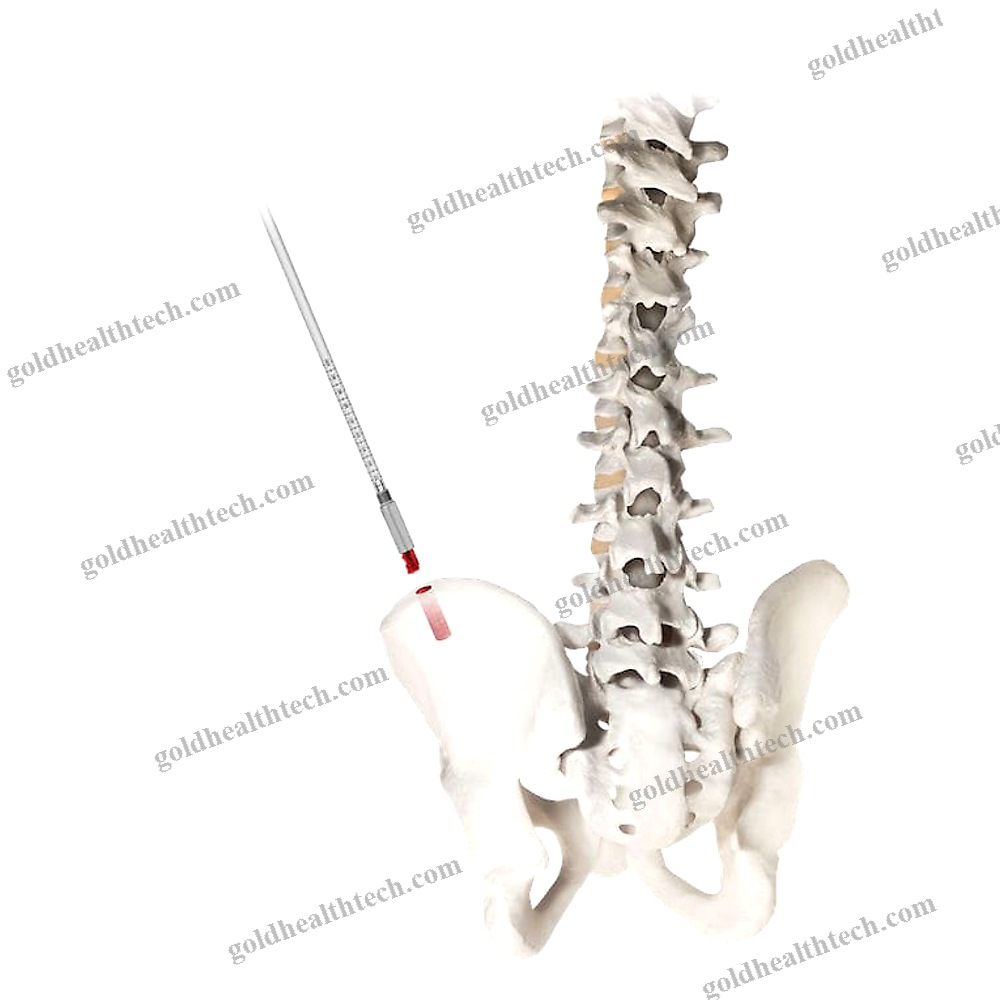 Bone Marrow Biopsy Needle