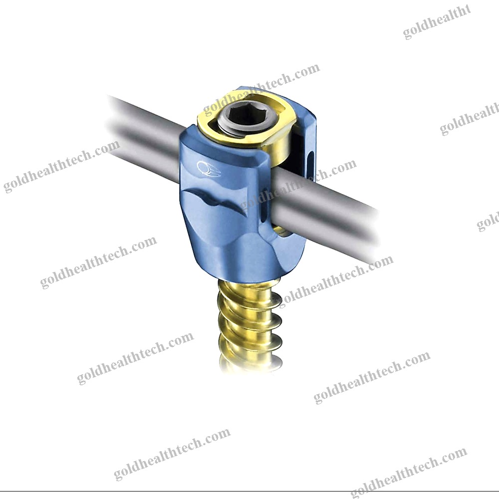 Lumbar-Sacral Vertebra Pedicle Screw