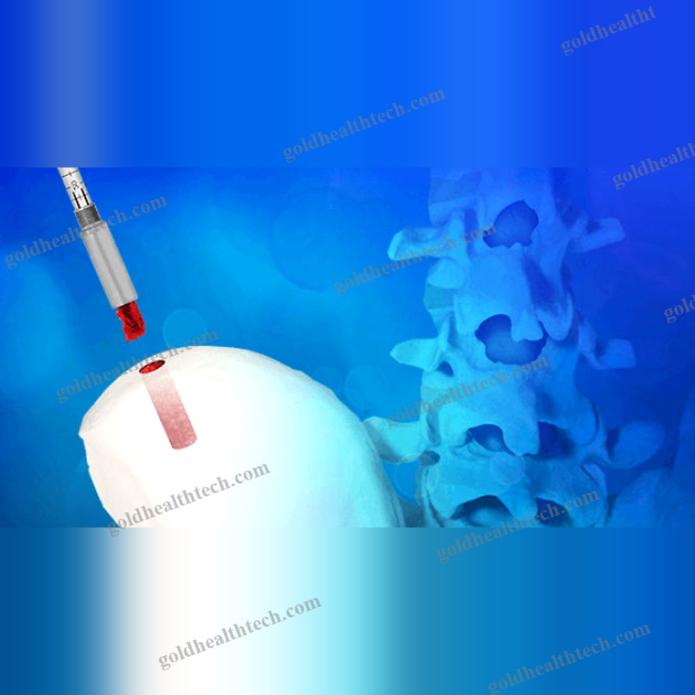 Bone Marrow Biopsy Needle