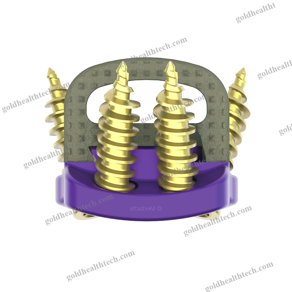 Cervical Interbody Fusion Cage