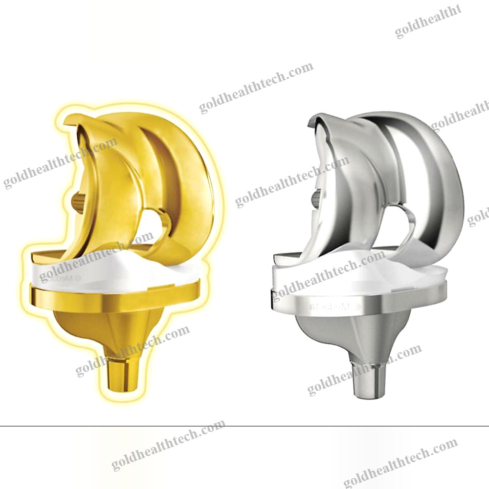 Total Knee Prosthesis