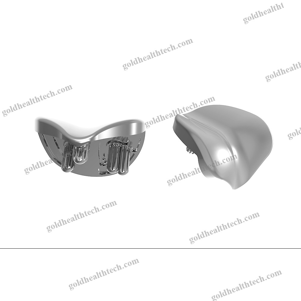 Unicompartmental Patello-Femoral Prosthesis