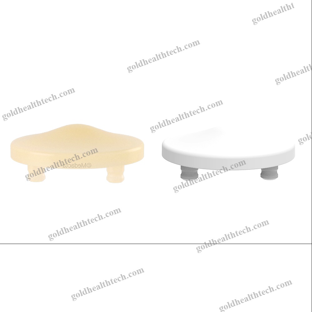 Unicompartmental Patello-Femoral Prosthesis